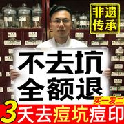 祛痘印痘坑痘疤凹洞修复填充再生男女士收缩毛孔淡化去痘印神器膏