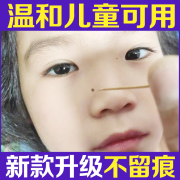 韦医生除痣灵点痣神器点痣水雀斑专用去痣膏脸部点痣膏无痕