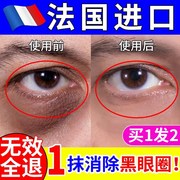 去除眼霜抗皱去淡化黑眼圈，眼袋细纹脂肪粒眼部，男士专用神器滋养