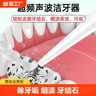 超声波洁牙器牙结石牙垢去除器牙齿，美白洗牙神器全自动家用美牙仪