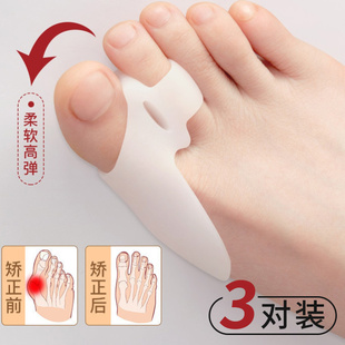 防磨脚趾套拇指外翻矫正器可以穿鞋硅胶大脚趾头外翻分趾器男女款