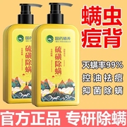 上海硫磺皂除螨沐浴露，孕妇儿童可用祛痘止痒硫黄香皂