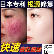 去红血丝修复角质层去除脸部过敏皮肤脸颊泛红修复受损肌肤护肤品