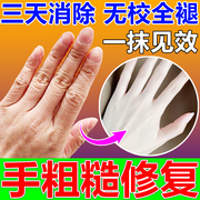 手粗糙修复嫩肤护手霜去手指关节皱纹干燥美白保湿精油