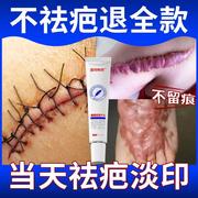 日本祛疤膏疤痕修复除疤膏，剖腹伤疤医用硅酮凝胶烫伤儿童增生凸起