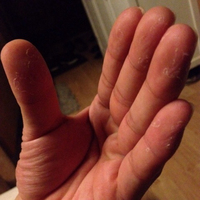 摸摸恢复手脱皮修复霜季节性，手掌手指头蜕皮开裂干裂褪起皮掉皮爆