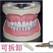 牙科耗材牙齿模型备牙排龈练习模型可拆卸口腔教学软牙龈