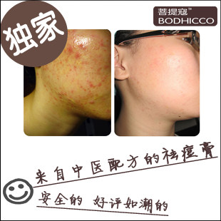 菩提寇 BODHICCO 植物配方粉刺暗疮祛痘霜  四瓶免邮