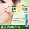 祛痘修复精华, 祛痘 抗痘 消印 粉刺 凹凸 ,口碑产品,速效!