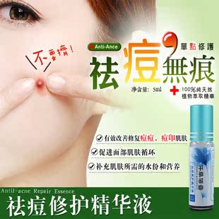 祛痘修复精华, 祛痘 抗痘 消印 粉刺 凹凸 ,口碑产品,速效!