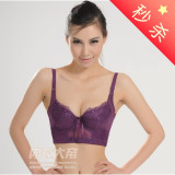 �ء�B43����ɱ5�۲�����Χ�������ſ۵����;�£����75-85BC