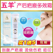 【五羊】产后疤痕多效霜/ 祛除剖腹产疤痕/手术烫烧伤疤痘印