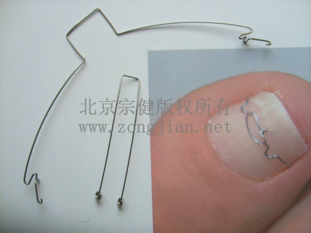 Ingrown toenails appliances Pedicure Nail groove orthopaedics Split correct tool Beijing Zong Jianin the Family/Personal Cleaning Tools , Personal care cleaning appliances , Nail clippers/Nail clippers , Nail/Manicure Set category - from Buy2taobao.com to provide professional Taobao agent buy service