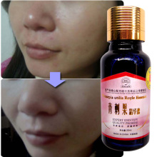 神奇亲试rarr;美特芙旗舰青刺果精华素斑‖皱‖疤‖痘印-乳液/面霜