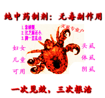 <em>虱子</em>热销爆款|头上长<em>虱子怎么办</em>,阴虱|淘宝虱子