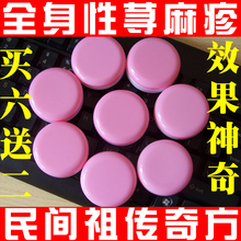 民间特效奇方|告别全身性荨麻疹|六盒一疗程180元，买六盒送二盒