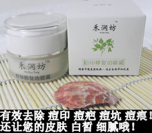 去痘痘印祛痘疤痘坑痘痕痘印产品禾润坊味地黄痘印修复功能霜有效