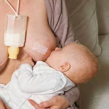 ��ʿ������Medela Supplemental Nursing System(SNS)����ι����