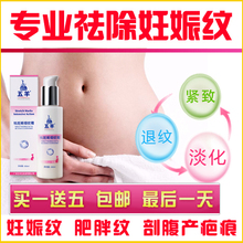 五羊产后妊娠纹消除/修复疤痕/肥胖纹/生长纹/收腹按摩油霜包邮