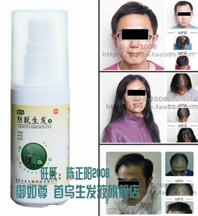 特价 30天狂销千件 止脱密发防脱发生发液育发液 正品带防伪