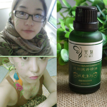 芙魅强效瘦脸精油 去咬肌 去双下巴 瘦脸颊 婴儿肥 热卖产品包邮
