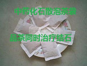 中药化石散治疗肾结石胆结石顽固石治好38MM