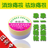 会林社 纯天然痔疮药混合痔 便秘 肛裂 销售量排名痔疮膏