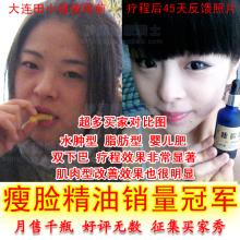 强效瘦脸精油50ML 秒杀瘦脸霜咬肌脂肪热卖产品 超级效果 2瓶包邮