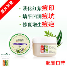 美肌优品百草祛痘印平疤修复霜50g去痘印痘坑痘疤凹洞正品祛痘印