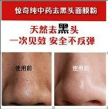 镇店秒杀 秘制纯中药去黑头面膜粉 白头粉刺 收毛孔 祛黑头 附图
