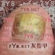 【7Y8 NET指甲水】 7Y8灰指甲水 灰甲水还你亮甲靓美甲
