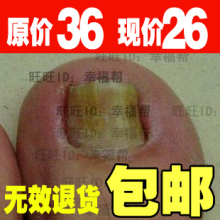 灰指甲 灰指甲脚气特效药 灰指甲无效退款 AME灰指甲专用药亮甲
