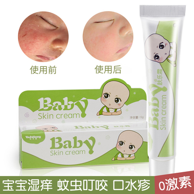 婴宝湿疹霜宝宝蚊虫叮咬止痒膏婴儿红屁股儿童护肤霜无激素消肿膏