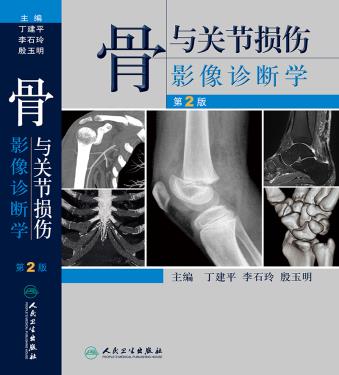 Xinhua Bookstore,joint damage image Diagnostics 2nd Edition) 9787117211222 Dingin the Books/Magazine/Newspaper , Medical Health , Medical Other category - from Buy2taobao.com to provide professional Taobao agent buy service