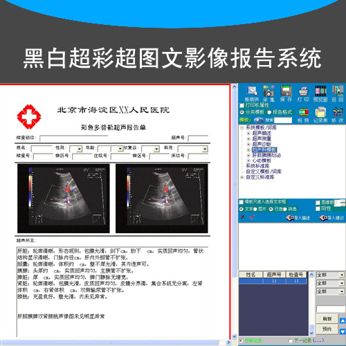 彩超黑白超病历图文影像报告系统B超软件视频采集卡脚踏板连接线在类目 电脑硬件/显示器/电脑周边, 电脑周边, 图文信息/采集卡中 - 来自Buy2taobao.com提供专业的淘宝代购服务