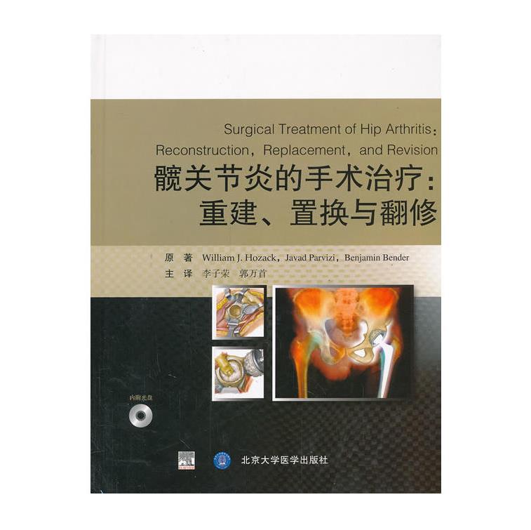 Genuine stock Hip Operation treatment reconstruction Replacement and renovation CD included Li Zi Rong/Guo Wan Shou Main translation Beijing University Medical Science press 9787565906640in the Books/Magazine/Newspaper , Medical Health , Medical Other category - from Buy2taobao.com to provide professional Taobao agent buy service