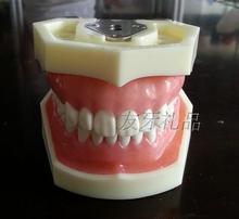 【备牙模型】最新最全备牙模型 产品参考信息