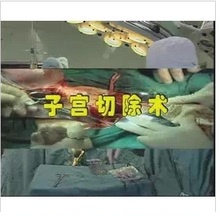 【妇产科手术光盘】最新最全妇产科手术光盘