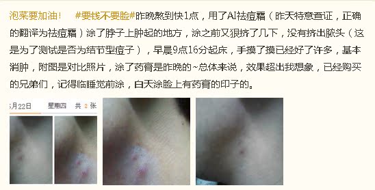 快速祛痘!美白!去痘印!Dr AI Acnes Labo药用祛