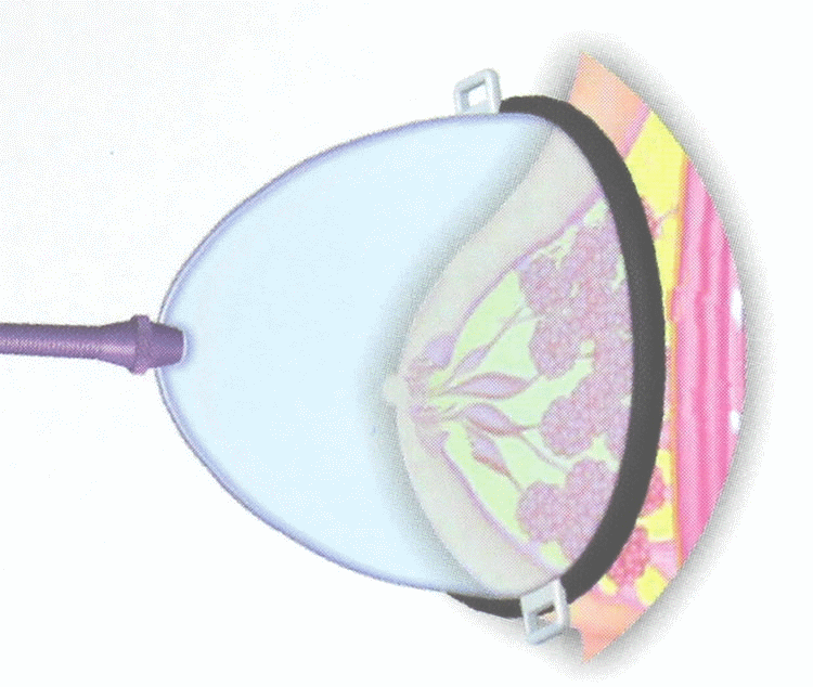 Female Breast Pump Enlargement Enhancement Enlarge 2 Cups Pink Color 
